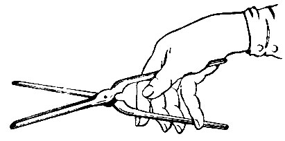 Рис. 5. Расположение пальцев на ручках щипцов