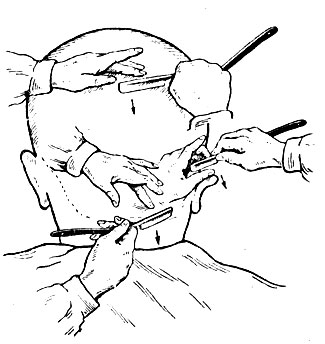 Рис. 79. Схема технологического процесса бритья волос задней части головы по первому разу