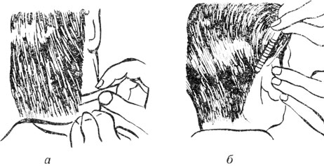 Рис. 19. Окантовка волос на правой стороне шеи: а - опасной бритвой; б - специальной безопасной бритвой для бритья